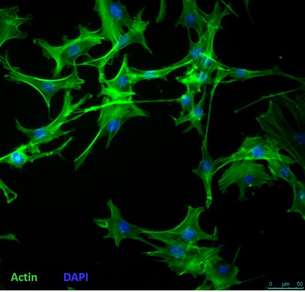 WT-1 Mouse Brown Preadipocyte Cell Line | SCC255